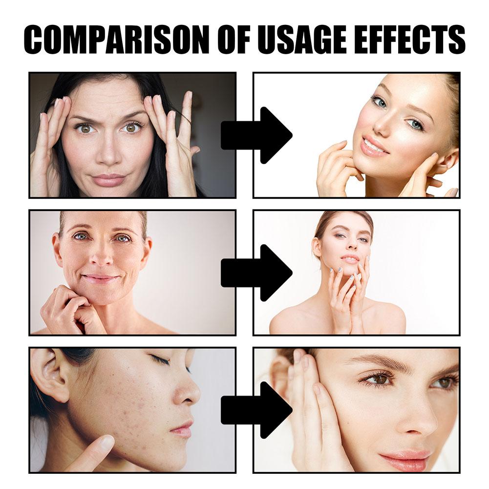 Крем с кровью дракона, удалени – обзор и цена Retinol Cream