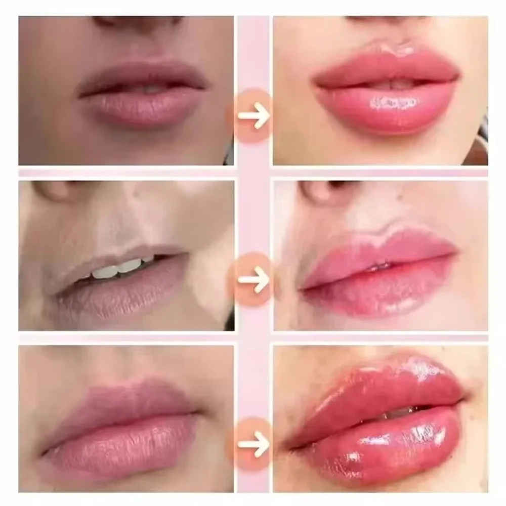 Быстродействующий увлажняющий  – обзор и цена Lip Balm